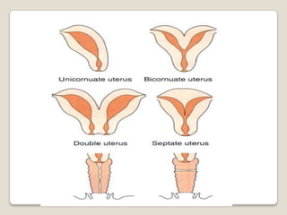 Gynecology 5th year, 2nd lecture (Dr. Hanaa)