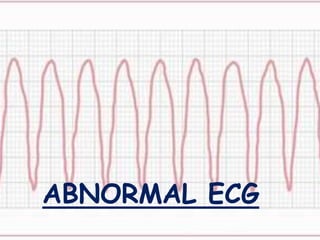 ABNORMAL ECG
 