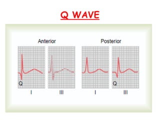 Abnormal Electrocardiography | PPTX