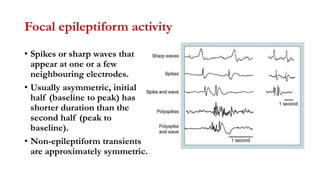 Focal epileptiform activity
• Spikes or sharp waves that
appear at one or a few
neighbouring electrodes.
• Usually asymmetric, initial
half (baseline to peak) has
shorter duration than the
second half (peak to
baseline).
• Non-epileptiform transients
are approximately symmetric.
 