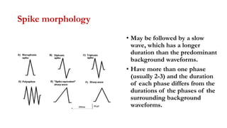 Spike morphology
• May be followed by a slow
wave, which has a longer
duration than the predominant
background waveforms.
• Have more than one phase
(usually 2-3) and the duration
of each phase differs from the
durations of the phases of the
surrounding background
waveforms.
 
