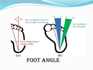 Normal Feet Angle Abnormal gait by SURYA LIKHITA-VAPMS COLLEGE OF PHYSIOTHERAPY | PDF