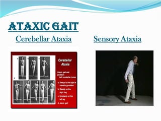 Abnormal gait by SURYA LIKHITA-VAPMS COLLEGE OF PHYSIOTHERAPY | PDF