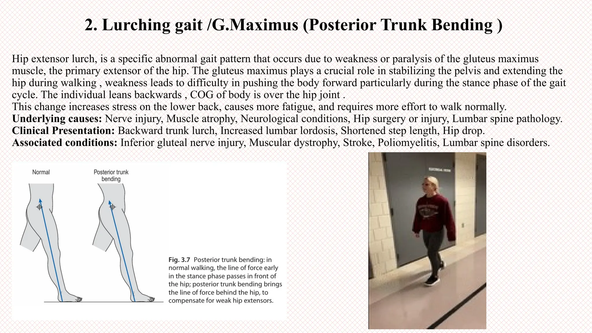 Abnormal Gait Pattern :Types and Causes. | PPTX, image size:2048x1152