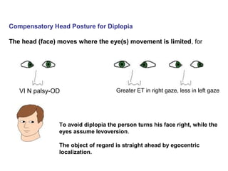 Abnormal Head Posture in squint | PPT