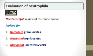 Evaluation of neutrophila
Needs careful review of the blood smear
looking for
1. Immature granulocytes
2. Nucleated erythrocytes
3. Malignant metastatic cells
1-CBC
 
