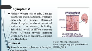 Symptoms:
Fatigue, Weight loss or gain, Changes
in appetite and metabolism, Weakness
especially in muscles, Decreased
libido, Irregular or absent menstrual
periodsin In women, Infertility,
Sensitivity to cold or difficulty staying
warm, Affecting thyroid hormone
levels, Low blood pressure, Joint pain
and Headaches.
Treatment:
Some hormone replacement therapies,
Figure #5: Hypopituitarism
https://images.app.goo.gl/dH3BYDG
REHLuj78k8
 