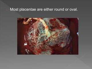 Most placentae are either round or oval.
 