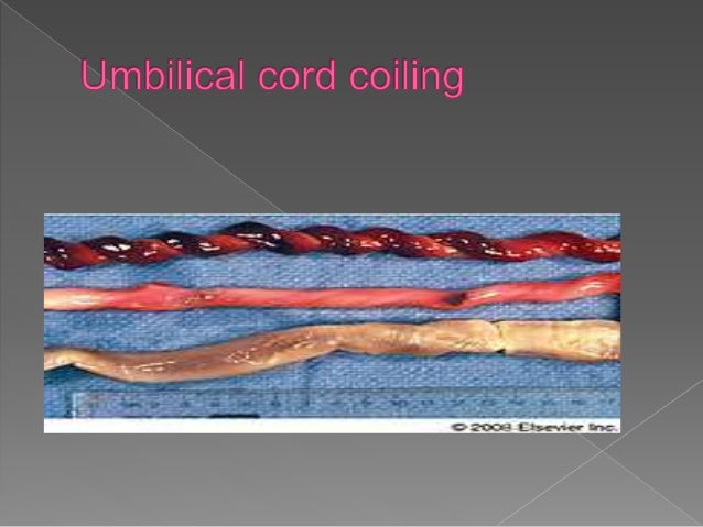 Abnormalities of cord & placenta