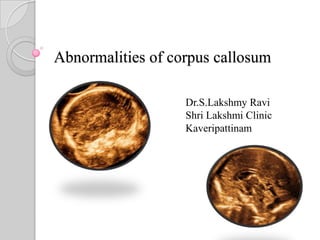 Abnormalities of corpus callosum
Dr.S.Lakshmy Ravi
Shri Lakshmi Clinic
Kaveripattinam
 