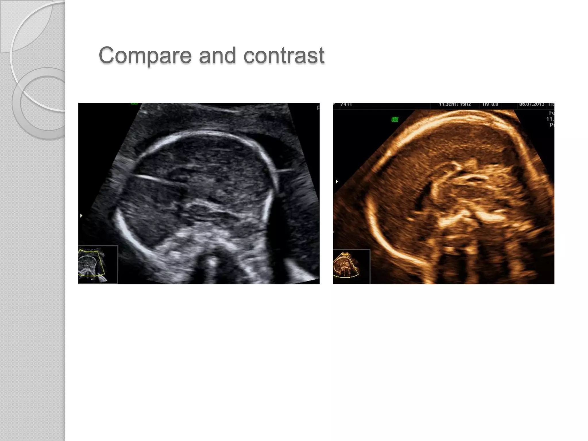 Compare and contrast
 