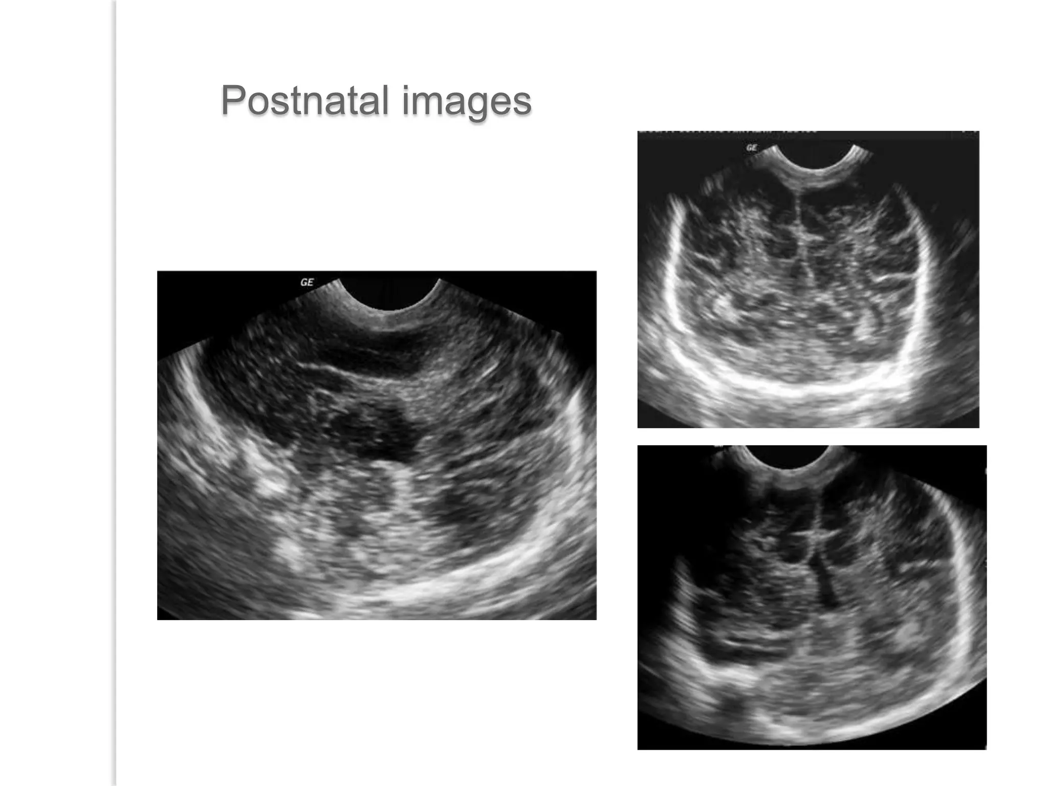 Postnatal images
 