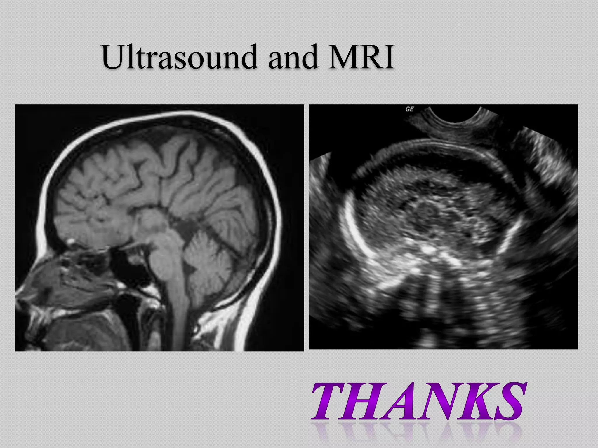 Ultrasound and MRI
 