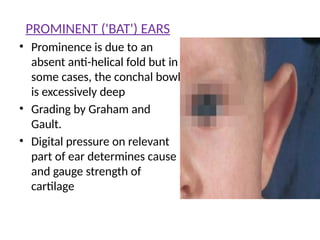 Comprehensive Overview of External Ear Abnormalities and Management | PPTX