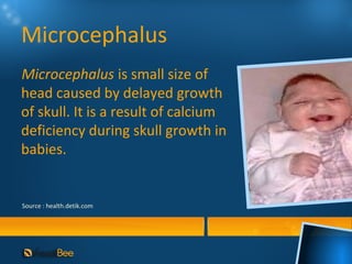 Abnormalities of movement system | PPT