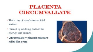 Chorionic Ring ABNORMALITIES OF PLACENTA (1).pdf by preeti kulshrestha | PDF