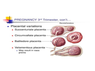 Comprehensive Overview of Placental and Umbilical Cord Abnormalities in ...