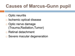 Causes of Marcus-Gunn pupil
 Optic neuritis
 Ischemic optical disease
 Optic nerve damage
(Trauma,Radiation,Tumor)
 Retinal detachment
 Severe macular degeneration
 