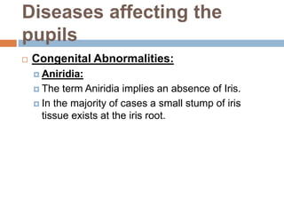 Diseases affecting the
pupils
 Congenital Abnormalities:
 Aniridia:
 The term Aniridia implies an absence of Iris.
 In the majority of cases a small stump of iris
tissue exists at the iris root.
 