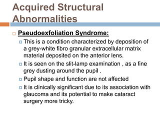 Acquired Structural
Abnormalities
 Pseudoexfoliation Syndrome:
 This is a condition characterized by deposition of
a grey-white fibro granular extracellular matrix
material deposited on the anterior lens.
 It is seen on the slit-lamp examination , as a fine
grey dusting around the pupil .
 Pupil shape and function are not affected
 It is clinically significant due to its association with
glaucoma and its potential to make cataract
surgery more tricky.
 