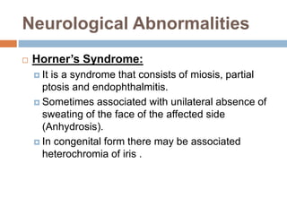 Neurological Abnormalities
 Horner’s Syndrome:
 It is a syndrome that consists of miosis, partial
ptosis and endophthalmitis.
 Sometimes associated with unilateral absence of
sweating of the face of the affected side
(Anhydrosis).
 In congenital form there may be associated
heterochromia of iris .
 
