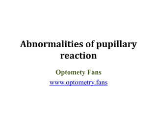 Abnormalities of pupillary
reaction
Optomety Fans
www.optometry.fans
 
