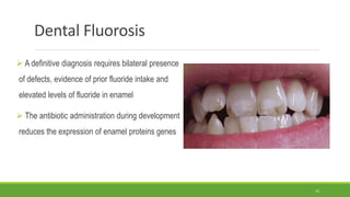 Dental Fluorosis
 A definitive diagnosis requires bilateral presence
of defects, evidence of prior fluoride intake and
elevated levels of fluoride in enamel
 The antibiotic administration during development
reduces the expression of enamel proteins genes
10
 