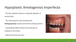 Hypoplastic Amelogenisis Imperfecta
o The basic alteration centres on inadequate deposition of
enamel matrix.
o The matrix present is well mineralized and
Radiographically contrasts well with the underlying dentine
o In generalized pattern pinpoint to pin head pits are
scattered on the surface.
o Staining of the pits may occur.
48
 
