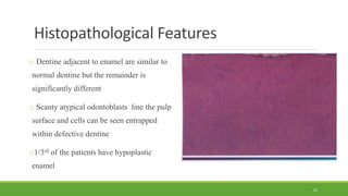 Histopathological Features
o Dentine adjacent to enamel are similar to
normal dentine but the remainder is
significantly different
o Scanty atypical odontoblasts line the pulp
surface and cells can be seen entrapped
within defective dentine
o1/3rd of the patients have hypoplastic
enamel
61
 