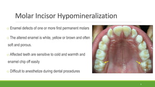Molar Incisor Hypomineralization
o Enamel defects of one or more first permanent molars
o The altered enamel is white, yellow or brown and often
soft and porous.
o Affected teeth are sensitive to cold and warmth and
enamel chip off easily
o Difficult to anesthetize during dental procedures
8
 