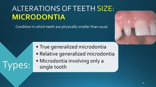 Micro Tooth Abnormalities of teeth | PPTX