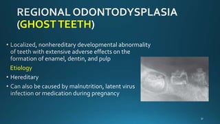 Abnormalities of teeth | PPTX