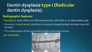 Abnormalities of teeth | PPTX