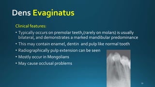 Abnormalities of teeth | PPTX
