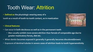 Abnormalities of teeth | PPTX
