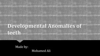 Developmental Anomalies of
teeth
Made by:
Mohamed Ali
 