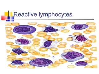Reactive lymphocytes
 