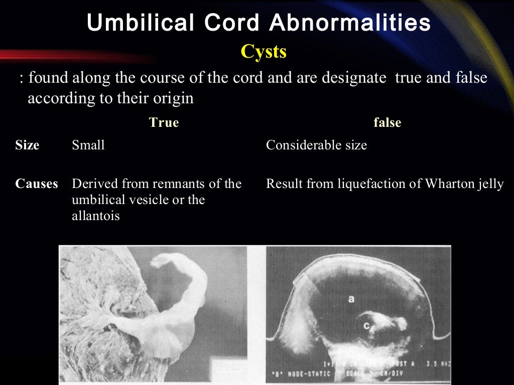 Abnormalities of the Placenta, Umbilical Cord and Membranes