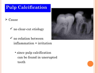 Abnormalities of the pulp | PPT