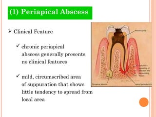 Skin Abscess Pulp Abnormalities of the pulp | PPT
