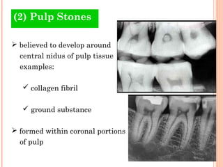 Abnormalities of the pulp | PPT
