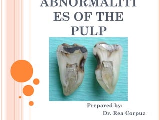 ABNORMALITI
 ES OF THE
   PULP




     Prepared by:
          Dr. Rea Corpuz
 
