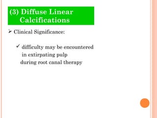 (3) Diffuse Linear
   Calcifications
 Clinical Significance:

    difficulty may be encountered
     in extirpating pulp...
