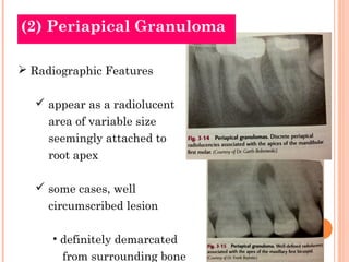 (2) Periapical Granuloma

 Radiographic Features

   appear as a radiolucent
     area of variable size
     seemingly a...