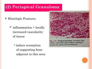 (2) Periapical Granuloma

 Histologic Features

    inflammation + locally
     increased vascularity
     of tissue

  ...
