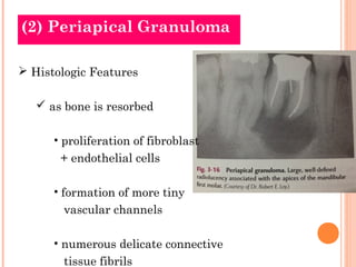 (2) Periapical Granuloma

 Histologic Features

    as bone is resorbed

      • proliferation of fibroblast
       + en...