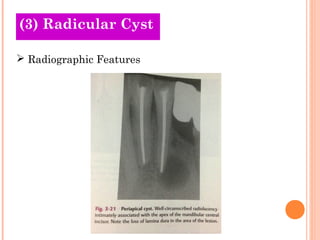 (3) Radicular Cyst

 Radiographic Features
 