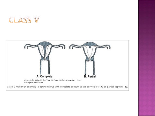 Abnormalities of the reproductive tract