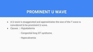 PROMINENT U WAVE
● A U wave is exaggerated and approximates the size of the T wave is
considered to be prominent U wave.
● Causes :- Hypokalemia
- Congenital long QT syndrome
- Hypocalcemia
 