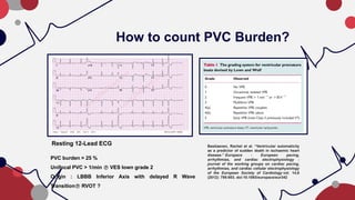 Abnormality Findings in Holter Monitoring, When to Refer.pptx